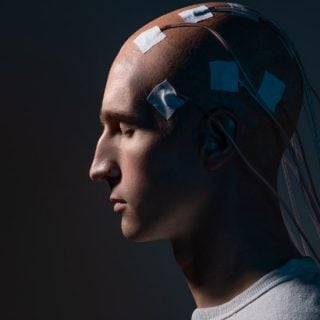 Brain implants