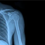 cancer diagnosis funding