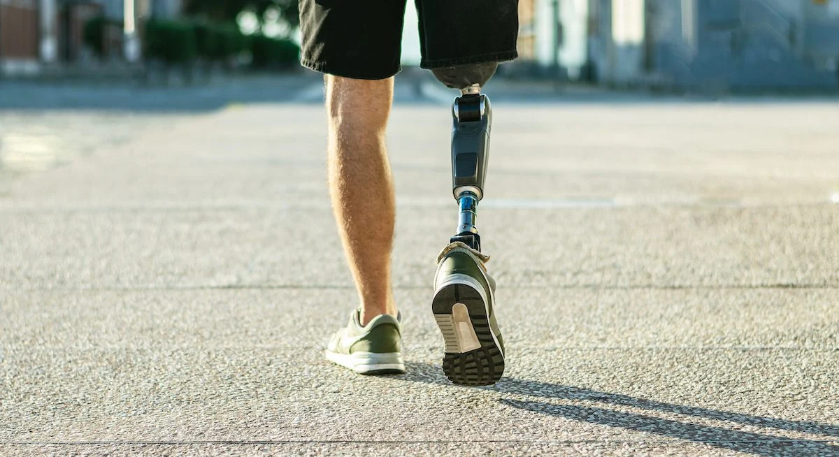 Birmingham’s Adapttech raises £2.25m for prosthetic technology