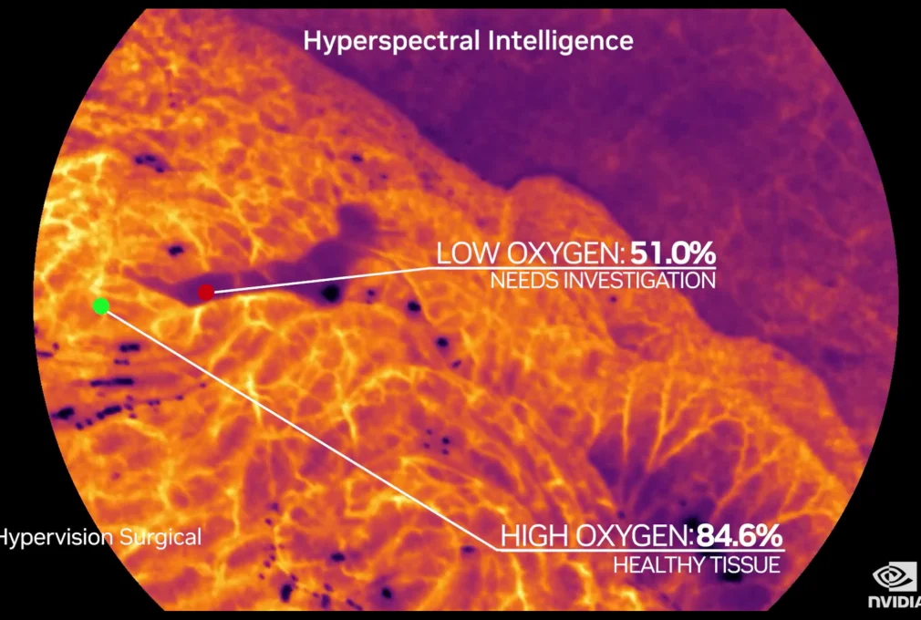 Hypervision Surgical