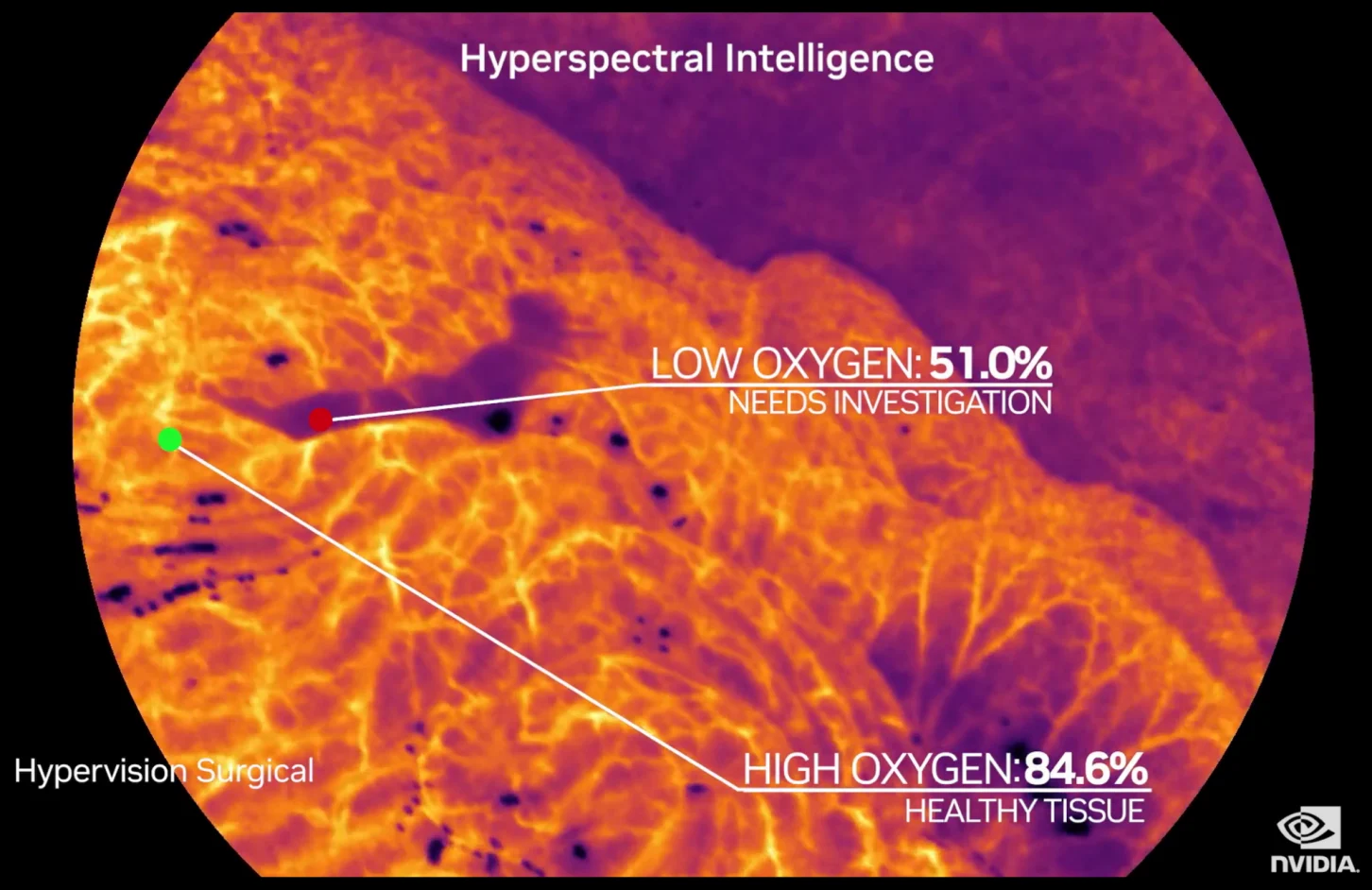 Hypervision Surgical