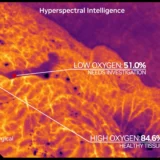 Hypervision Surgical