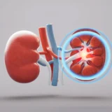 Mironid Series B raise kidney disease